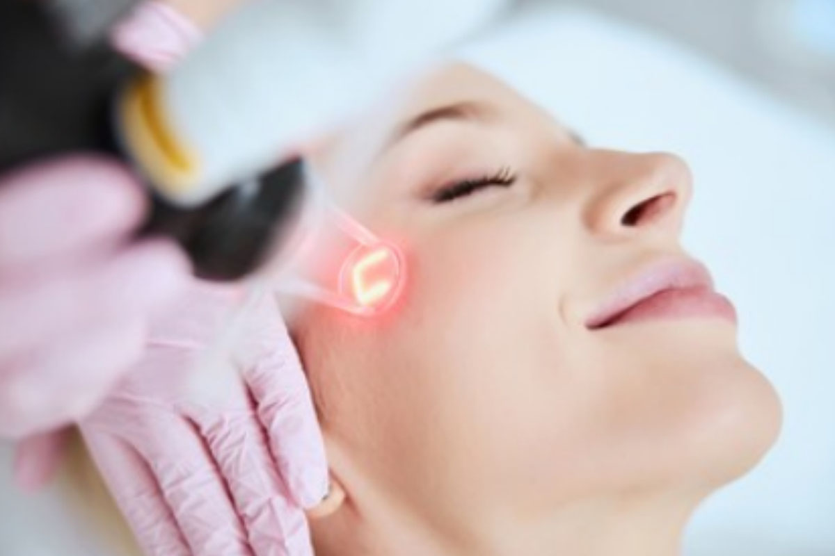 Fractional Laser Resurfacing