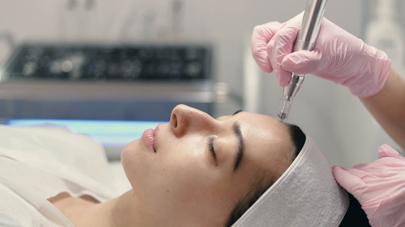 Microneedling Treatment Center Hiranandani Estate Thane