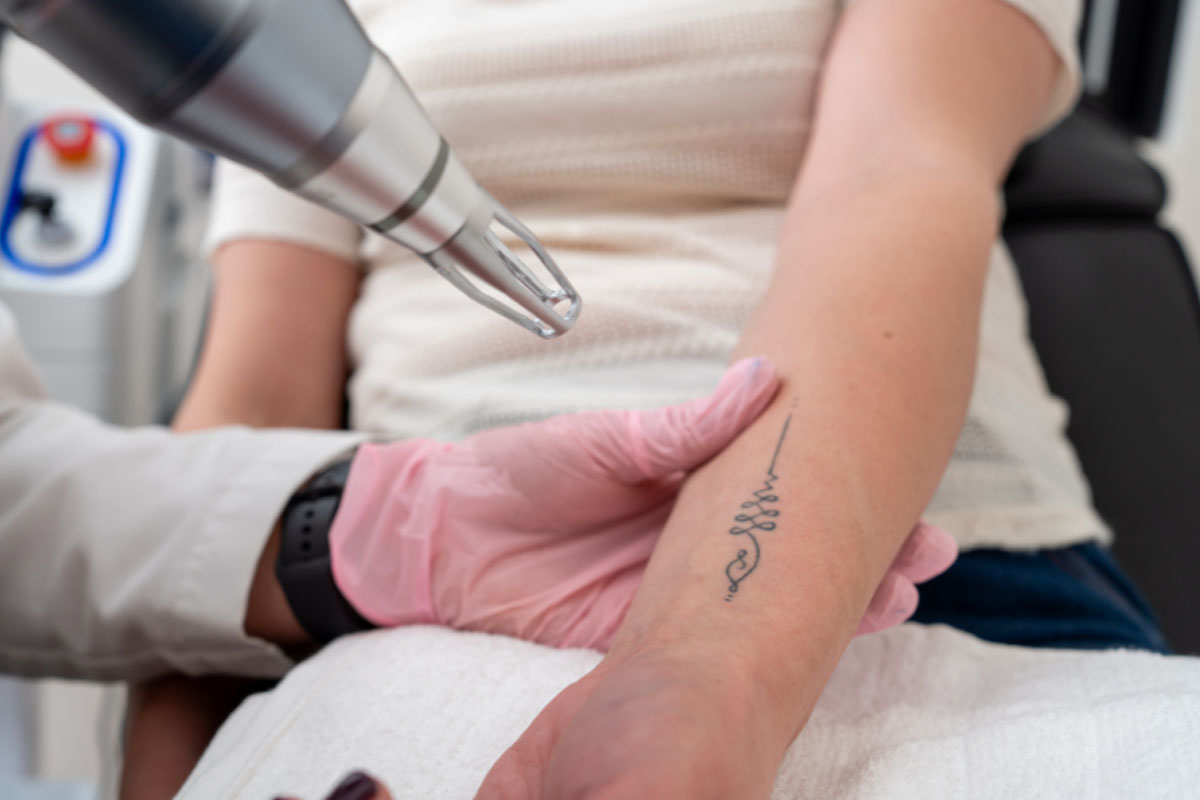Tattoo Removal Treatment